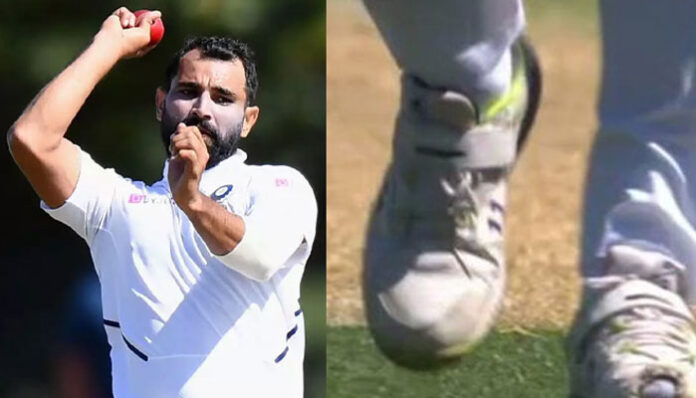 Shami wears shoe with toe cut-out