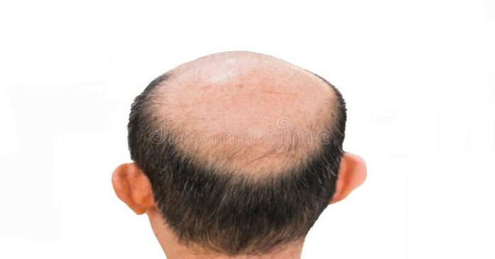 bald-head