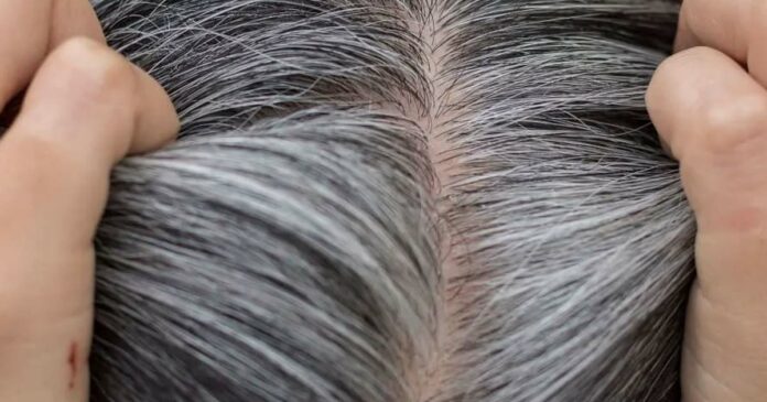 herbal-medicine-for-grey-hair