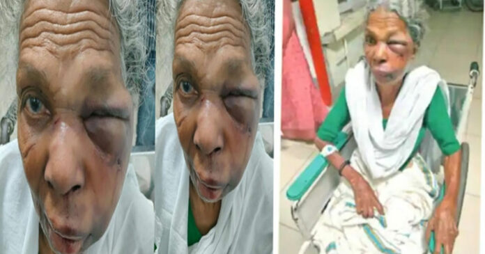 Elderly Woman Attacked
