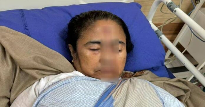 Mamata Banerjee is seriously injured and undergoing treatment; Trinamool should share pictures and include them in prayers; Unclear how the accident happened