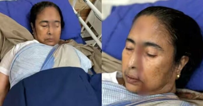 Four stitches in forehead; Critically injured West Bengal Chief Minister Mamata Banerjee has been discharged from the hospital and has been instructed to rest